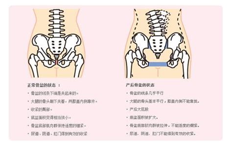 骨盆有痣